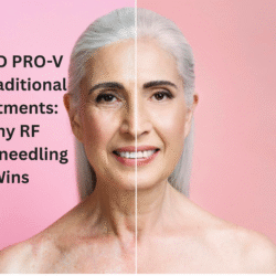 NODD PRO-V vs. Traditional Treatments: Why RF Microneedling Wins