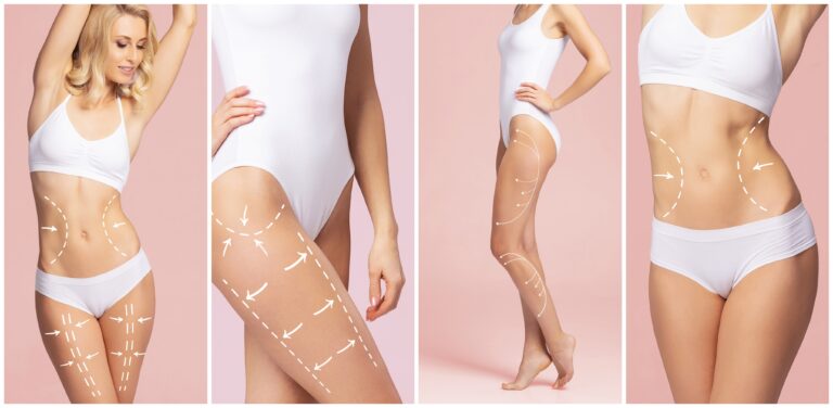 CoolShape 360° Glow: 5 Bold Steps to Sculpted Elegance